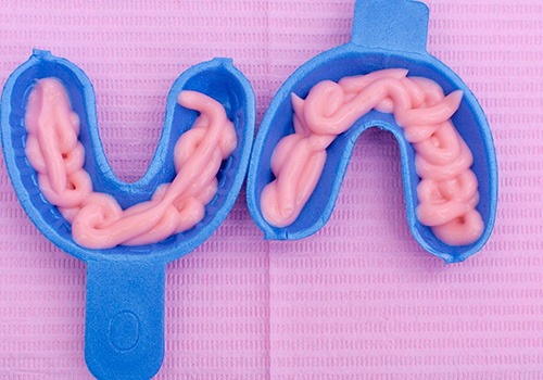 Fluoride treatment foam