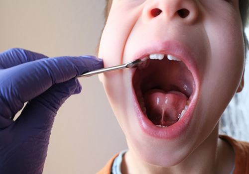 Dentist inspecting a child’s mouth