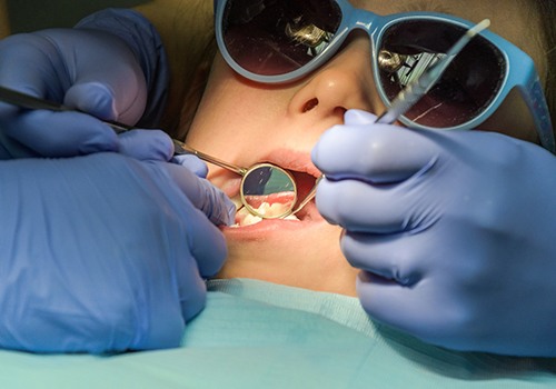 Close up of dentist examining a child’s mouth